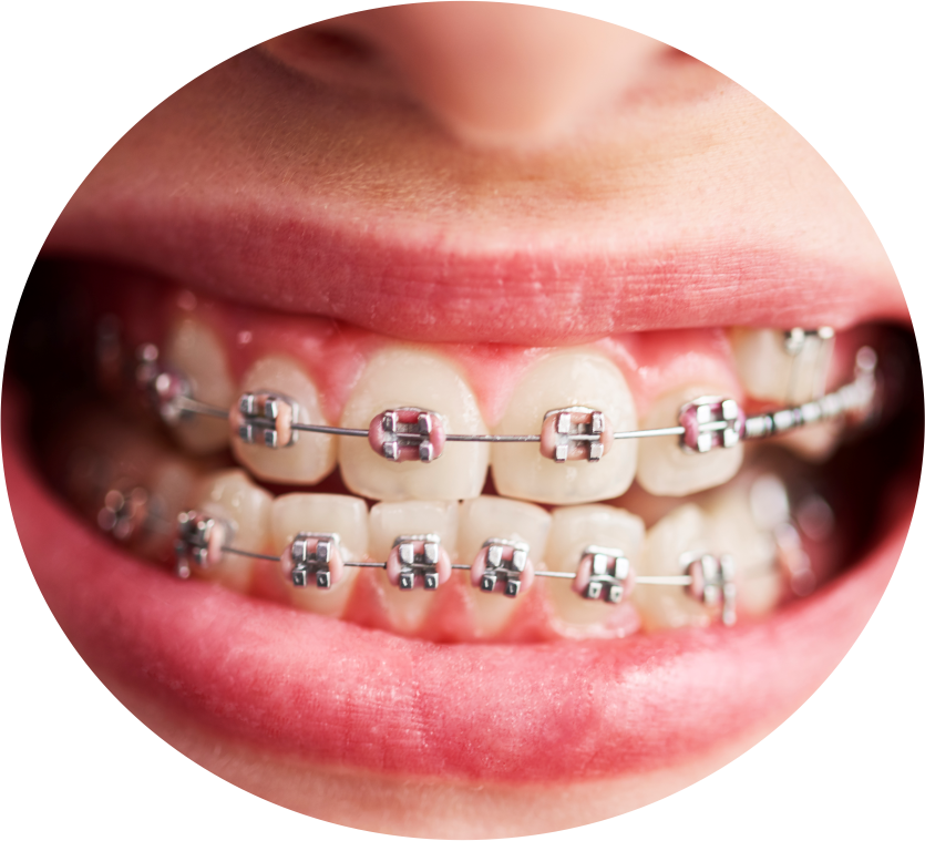 aparelhos odontologicos